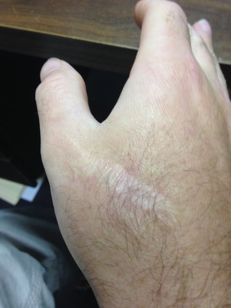 hand.jpg
