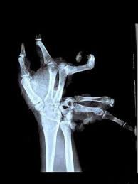 hand.jpg