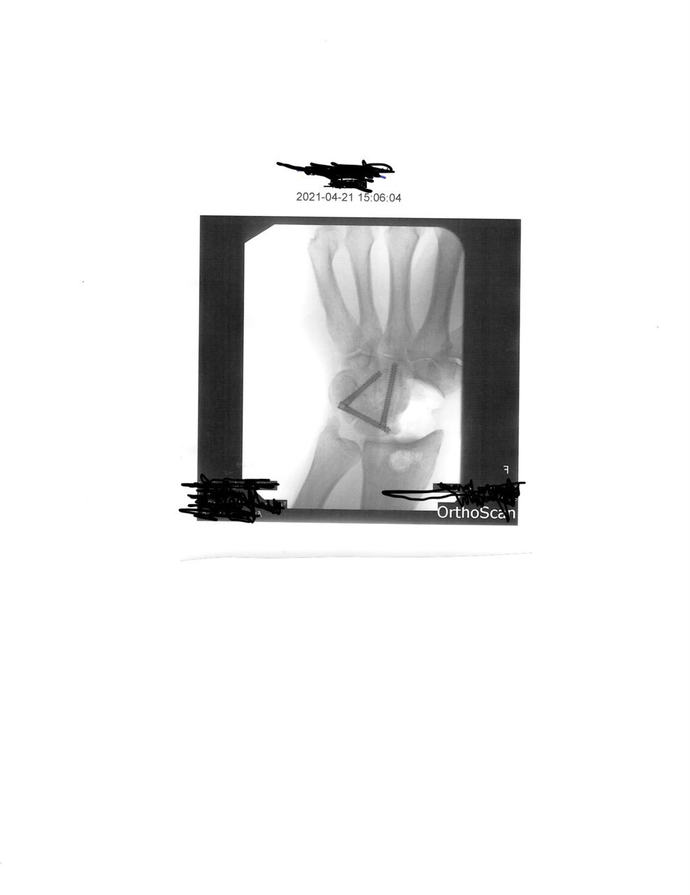 hand.jpg