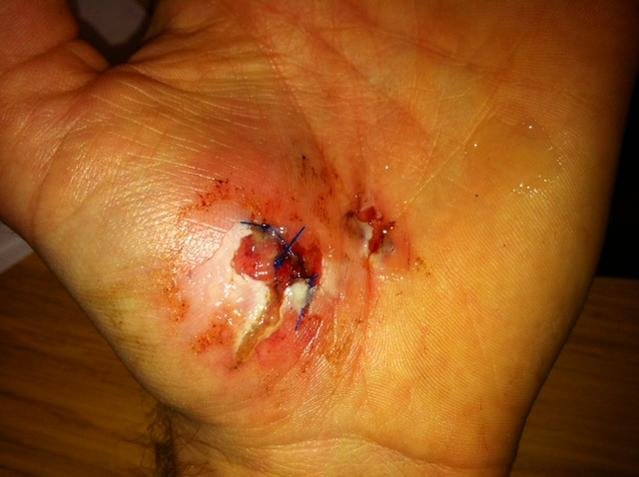 hand1.jpg