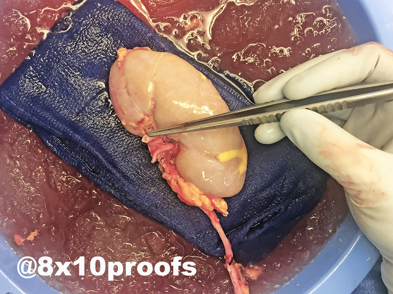 Kidney-0003a.jpg