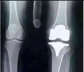 Knee X-Ray.gif