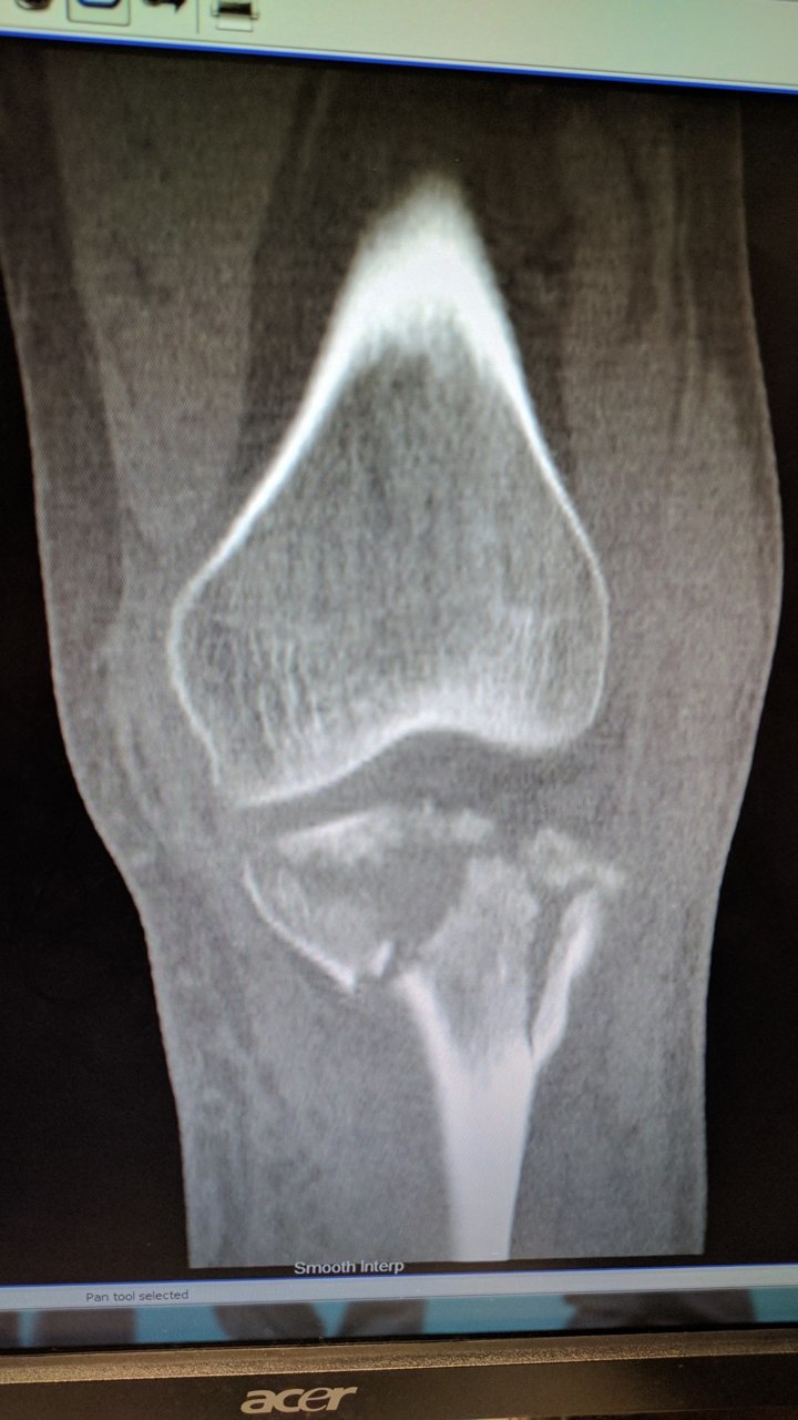leg1.jpg