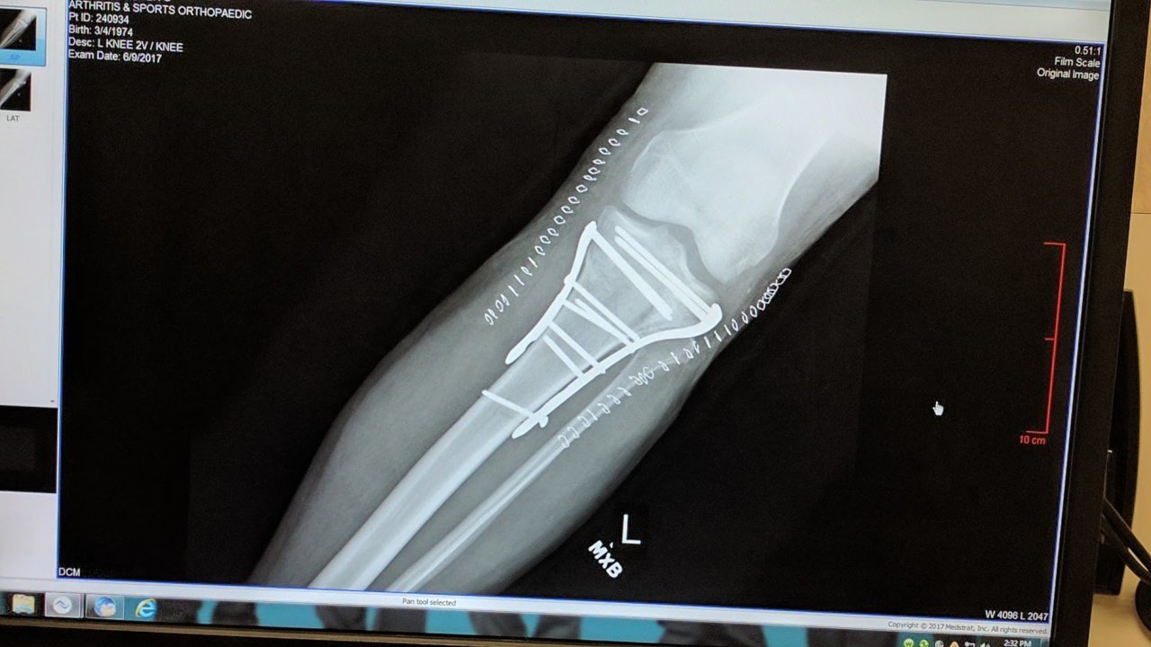 leg2.jpg