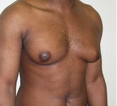 man-boobs.jpg