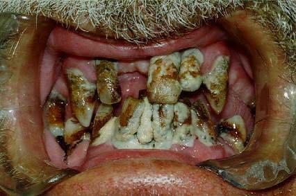 nasty-3_855e24842334d203ee57772c1e82a78ae61c8b22.jpg