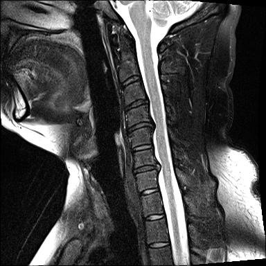 neck0002.jpg