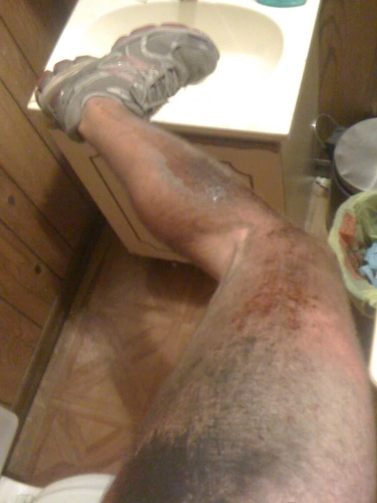 pain2_7d9fb6a93cb91b04be0a77837975faedc81d23b1.jpg