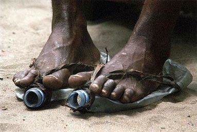 Poor Feet1.jpg