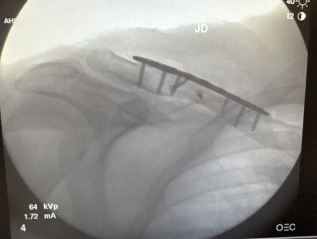 Post op picture for patient to see.jpg