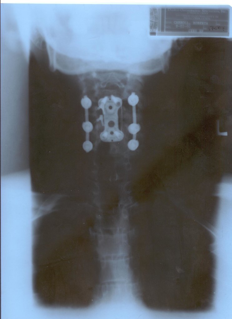 robi-neck-back.jpg