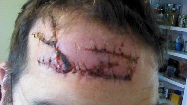 Scar 3.jpg