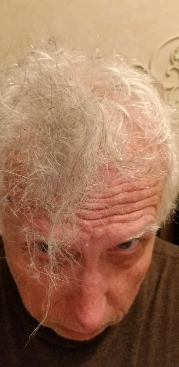 Shedding.jpg