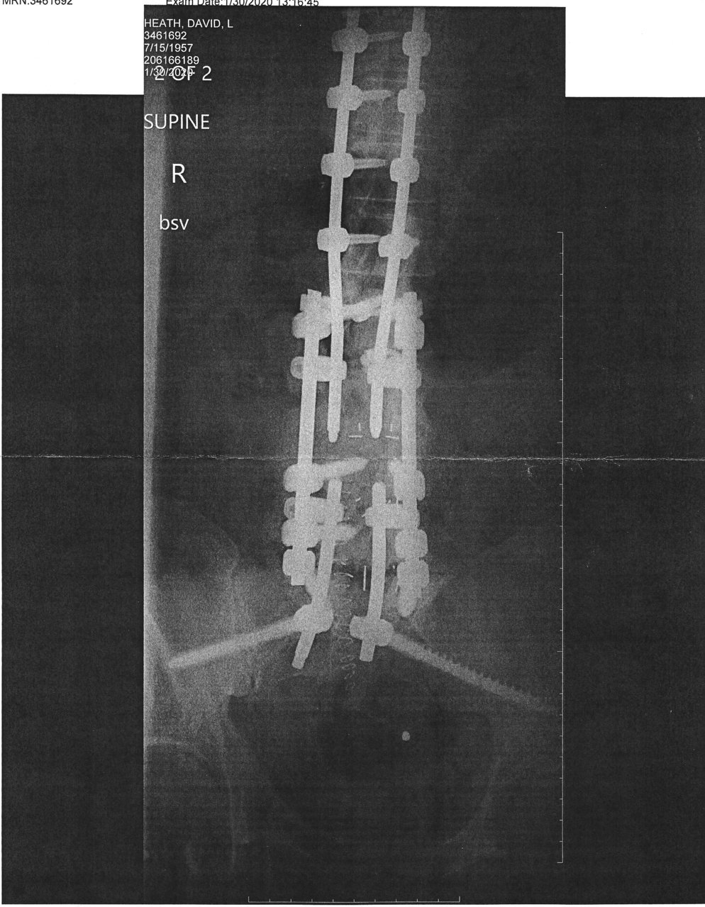 Spine.jpg