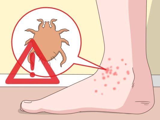 Stop-Itchy-Feet-Step-12.jpg.cf.jpg