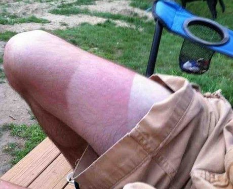 suntan-fails-4-1532345178-view-0.jpg