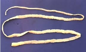 tapeworm_045e45046f727235f7fbdd202fbe80388521eae3.jpg