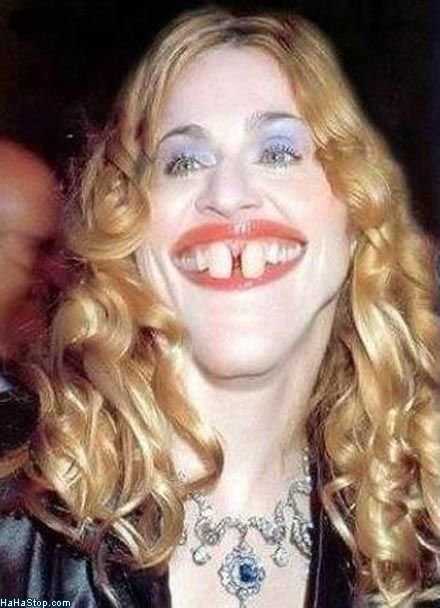 teef.jpg