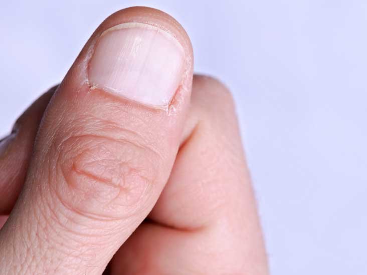 thumb-732x549-thumbnail.jpg