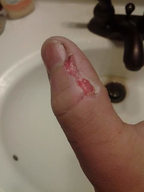 thumb.jpg