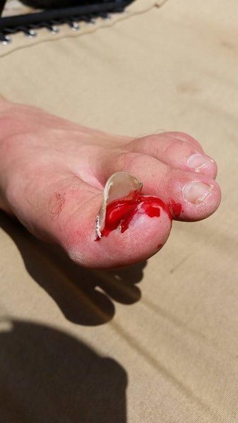 toe.jpg