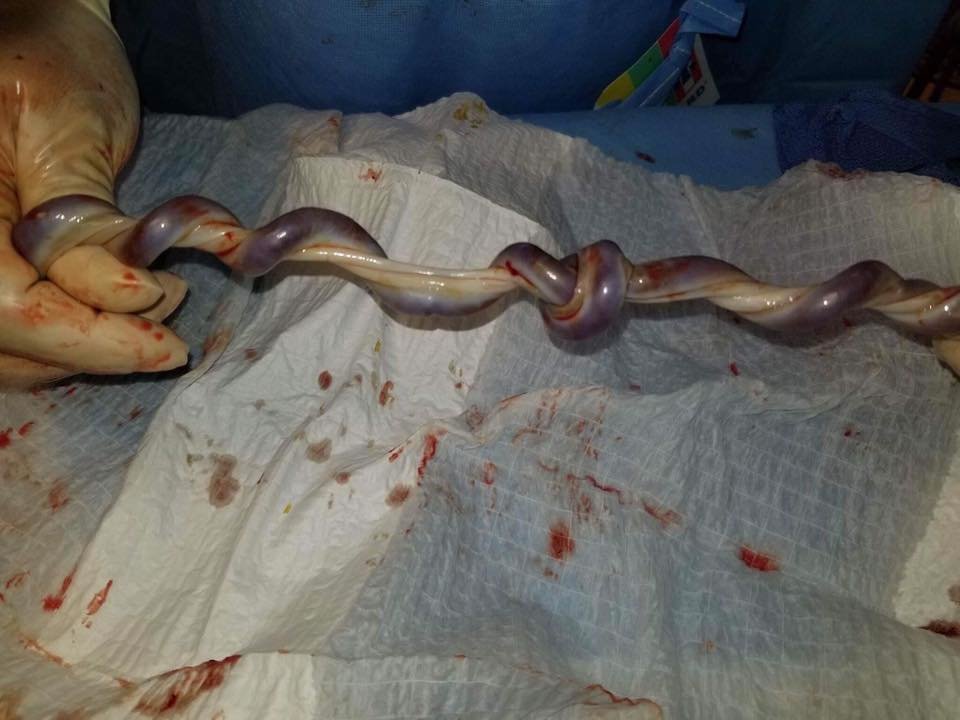 Umbilical.jpg