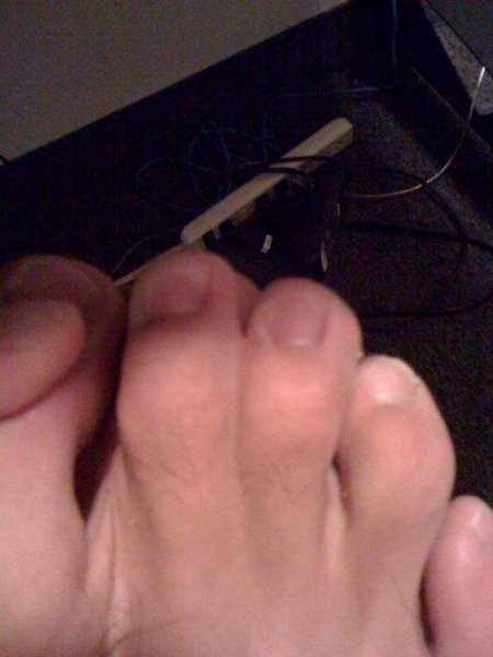webbed toes.jpg