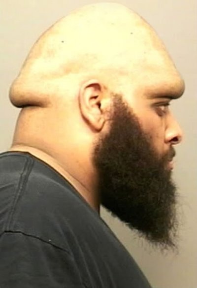 what-a-dick-head.jpg