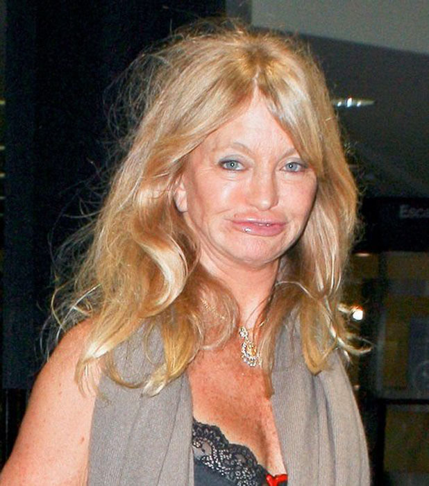 what_has_goldie_hawn_done_to_her_face_06.jpg