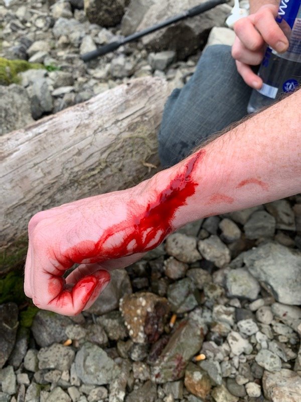 wound.jpg