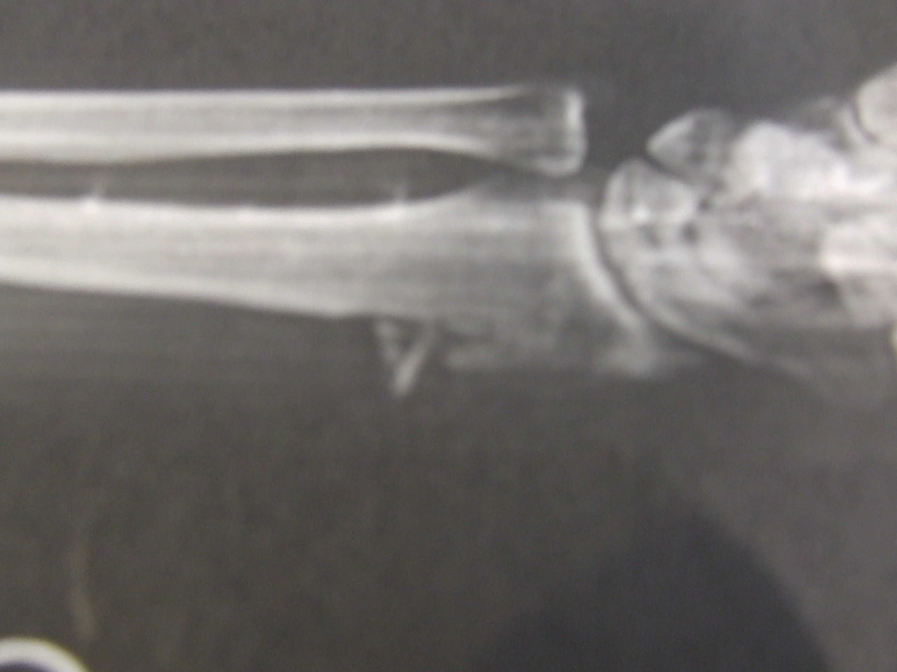 wrist xray 0002.jpg
