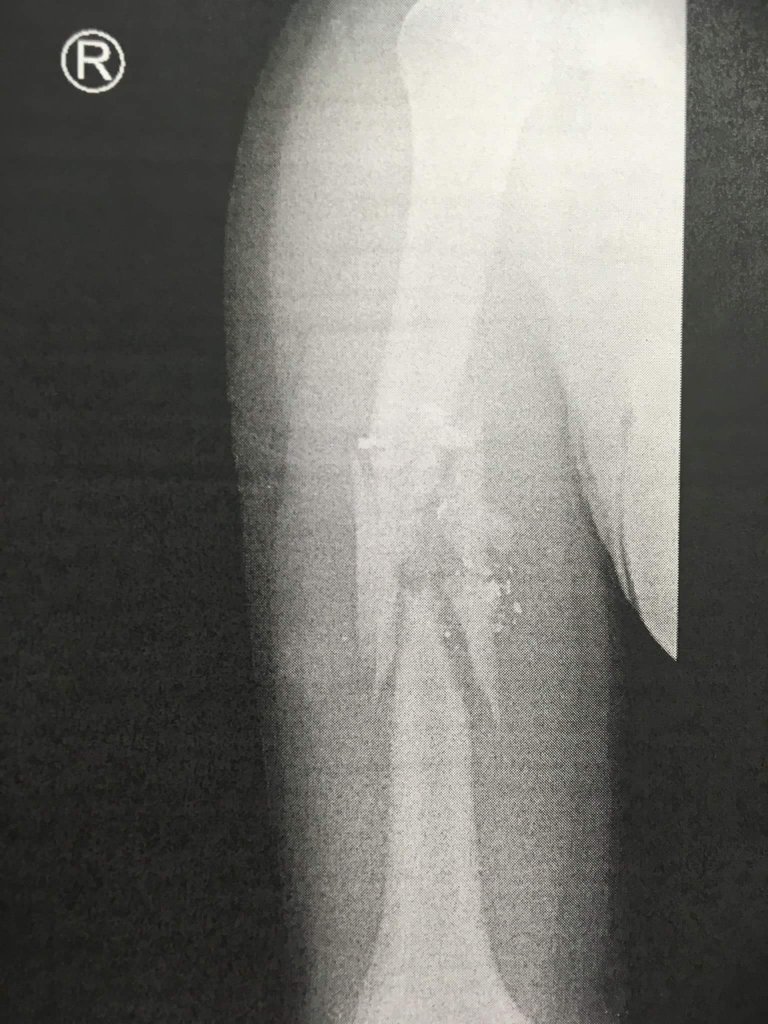 x-ray.jpg