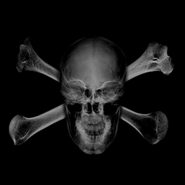 xray-skulls-cross-bones.jpg