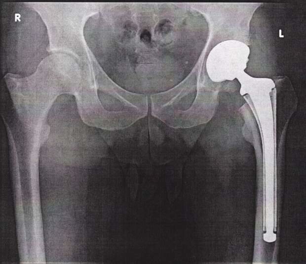xray2.jpg