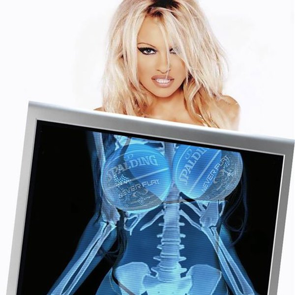 xrayvision.jpg