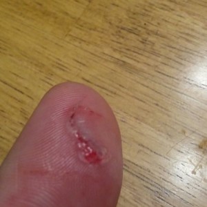 Kydex injury