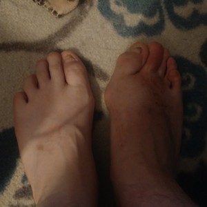 Foot 9-26-17