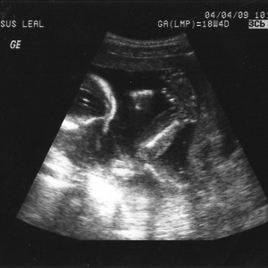 My kiddo as of April 03 2009