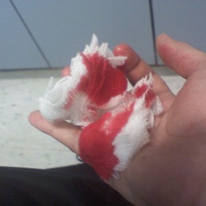 cut my finger at work today.... waiting for stitches