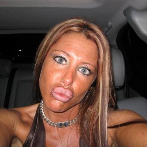 ugly-bitch