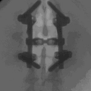 spine