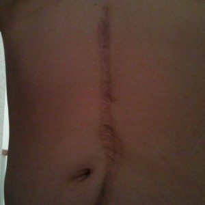 Chicks do dig scars. ;)