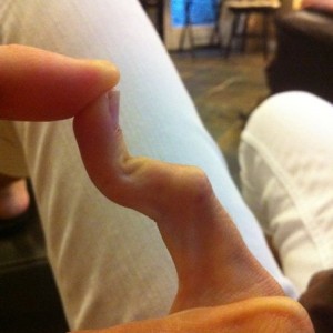 Been married 5 years... Just discovered my wife's pinky can do this...