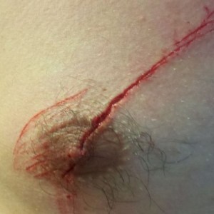 Cut my nipple in half