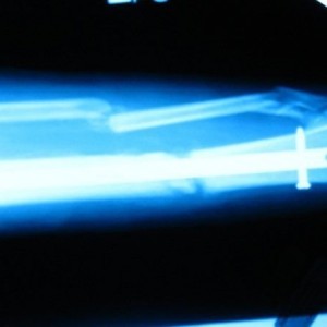 blu2