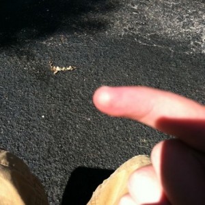 Burnt finger. And it hurts like a mo fo!