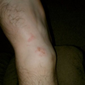 soccer wound // sent from my droid