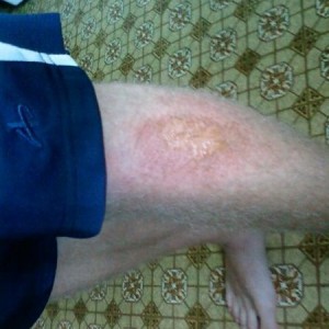 Fuuuuuck that hurts