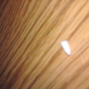 My son lost his first tooth