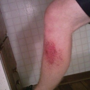 Fuck me. Tore the shit out of my leg